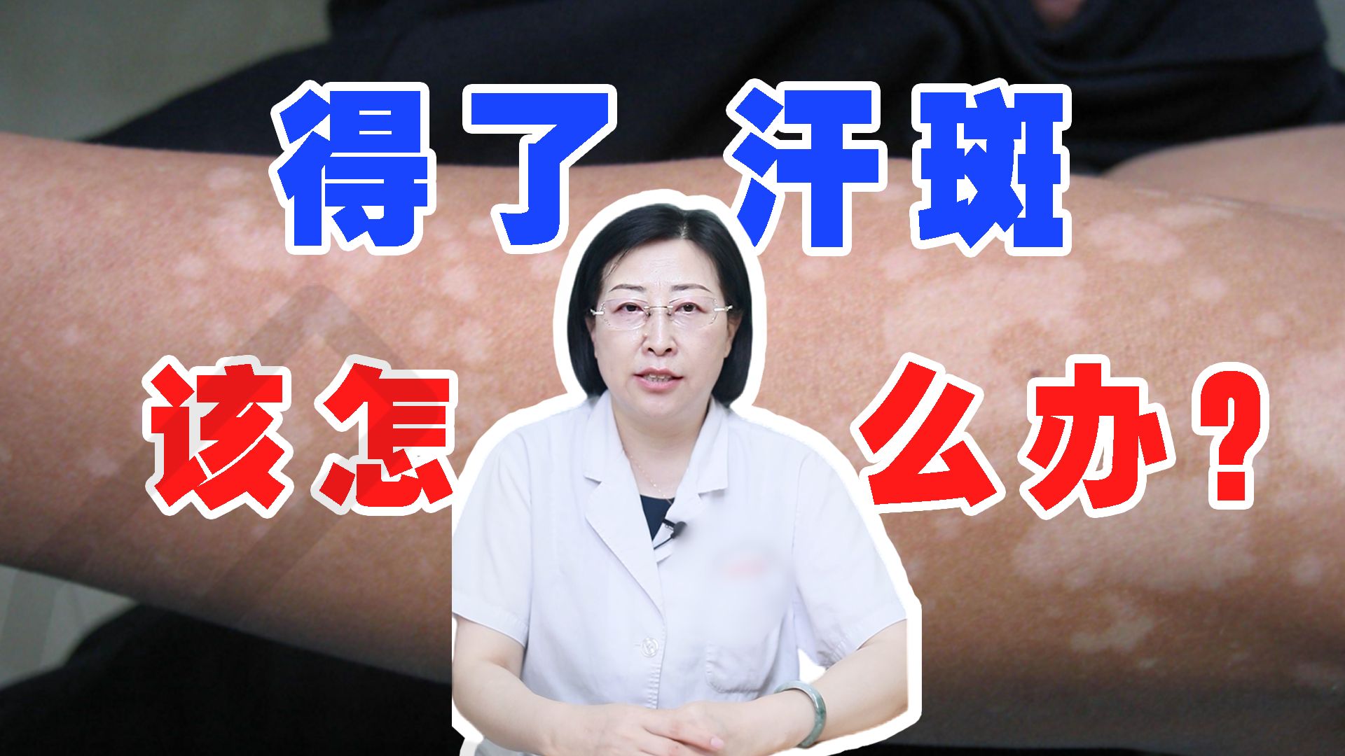 得了汗斑该怎么办?