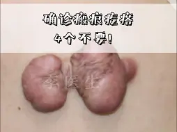 Download Video: 确诊瘢痕疙瘩4个不要！