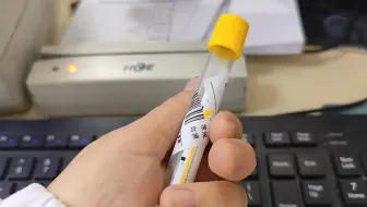 那些让检验科血压狂飙的条码贴，你遇到过几种？