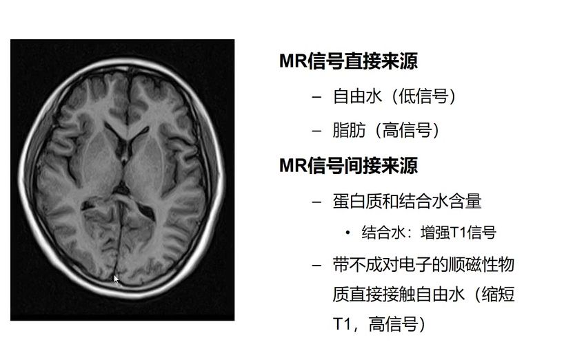 [图]中枢神经系统MR诊断