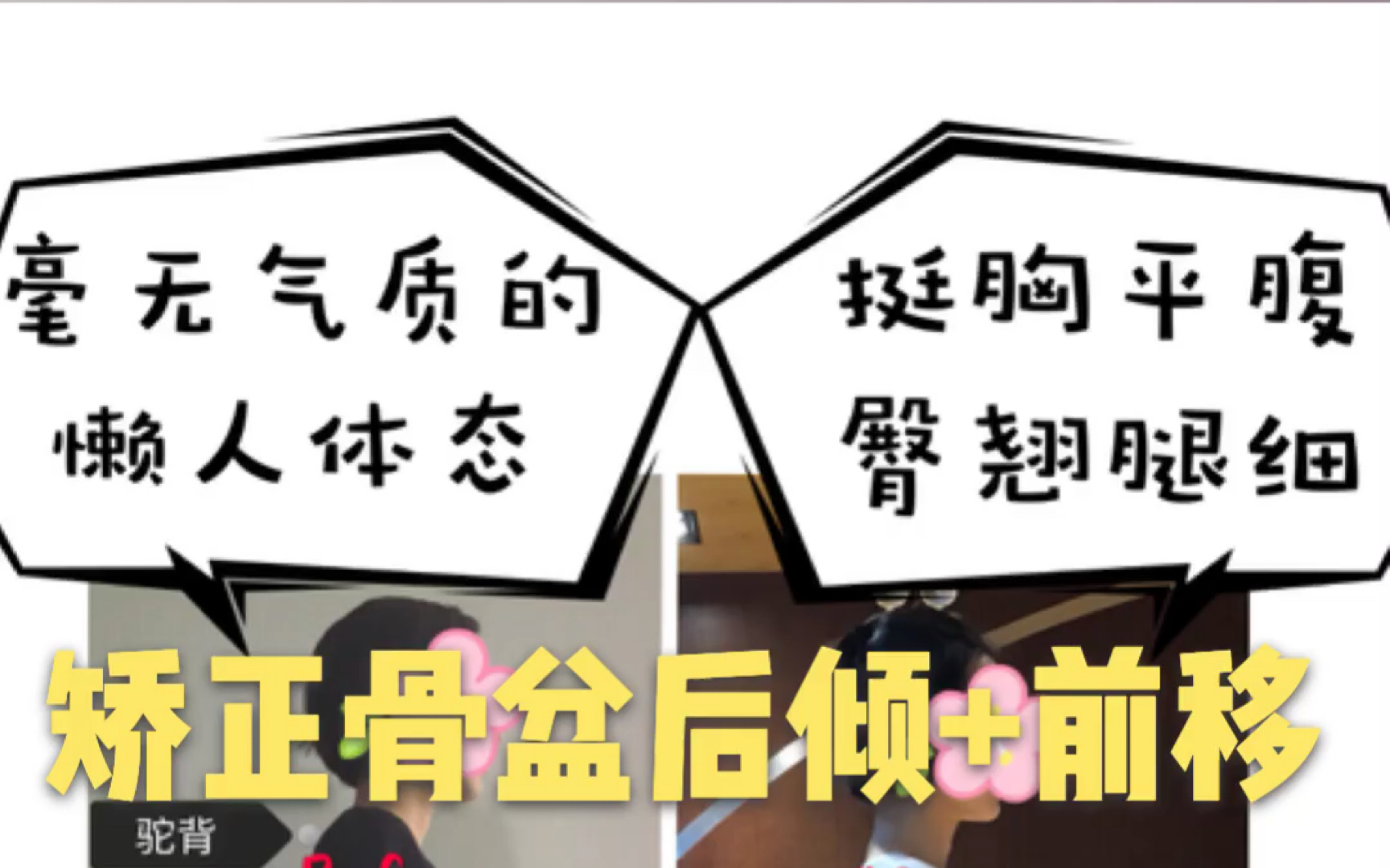 骨盆前移—懶人體態!矯正!