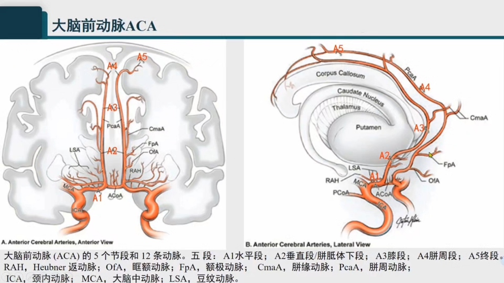 右侧大脑前动脉a1图片