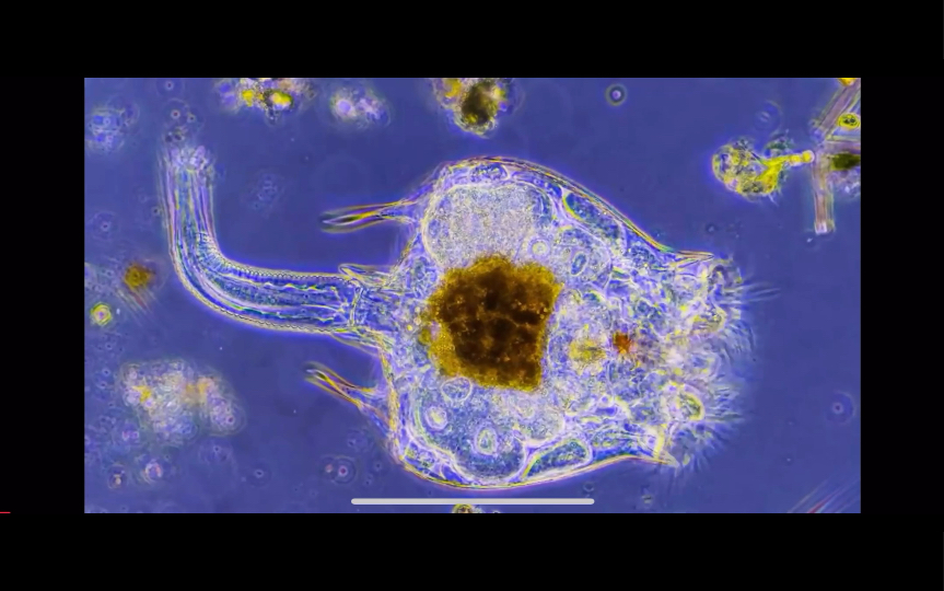 【微观旅途】轮虫:迷人又神奇的生物