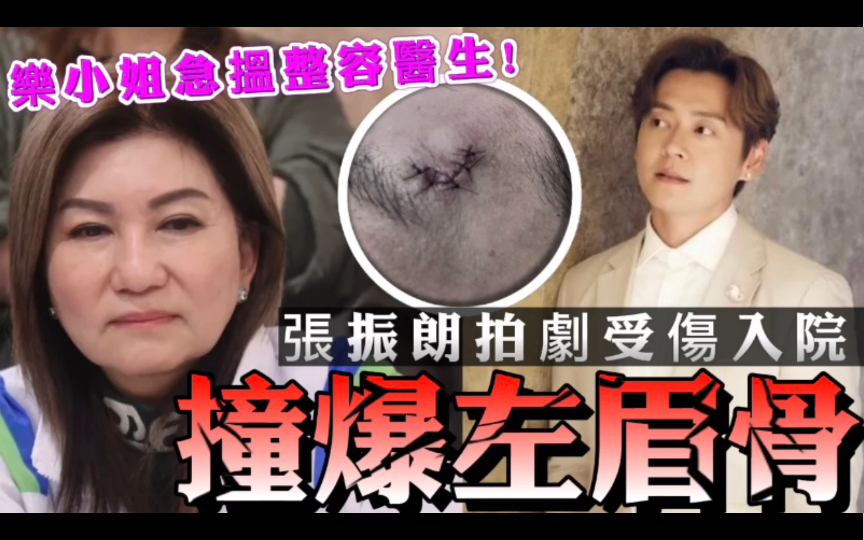 [图]超级黑仔王！TVB力捧小生拍剧受伤撞爆眉骨，高层急安排整容医生