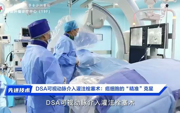 dsa可视微创动脉介入灌注栓塞术,癌细胞的"精准"克星!