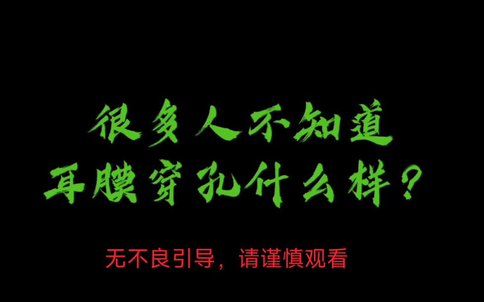 高清双主机耳鼻喉可视仪,山东通耳可视采耳设备厂家出品哔哩哔哩bilibili