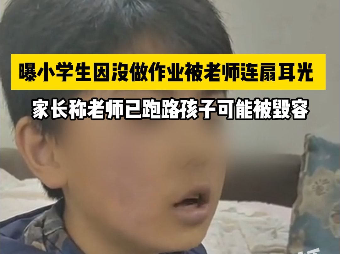 曝小学生因没做作业被老师连扇耳光,家长:孩子可能被毁容,老师跑路了哔哩哔哩bilibili