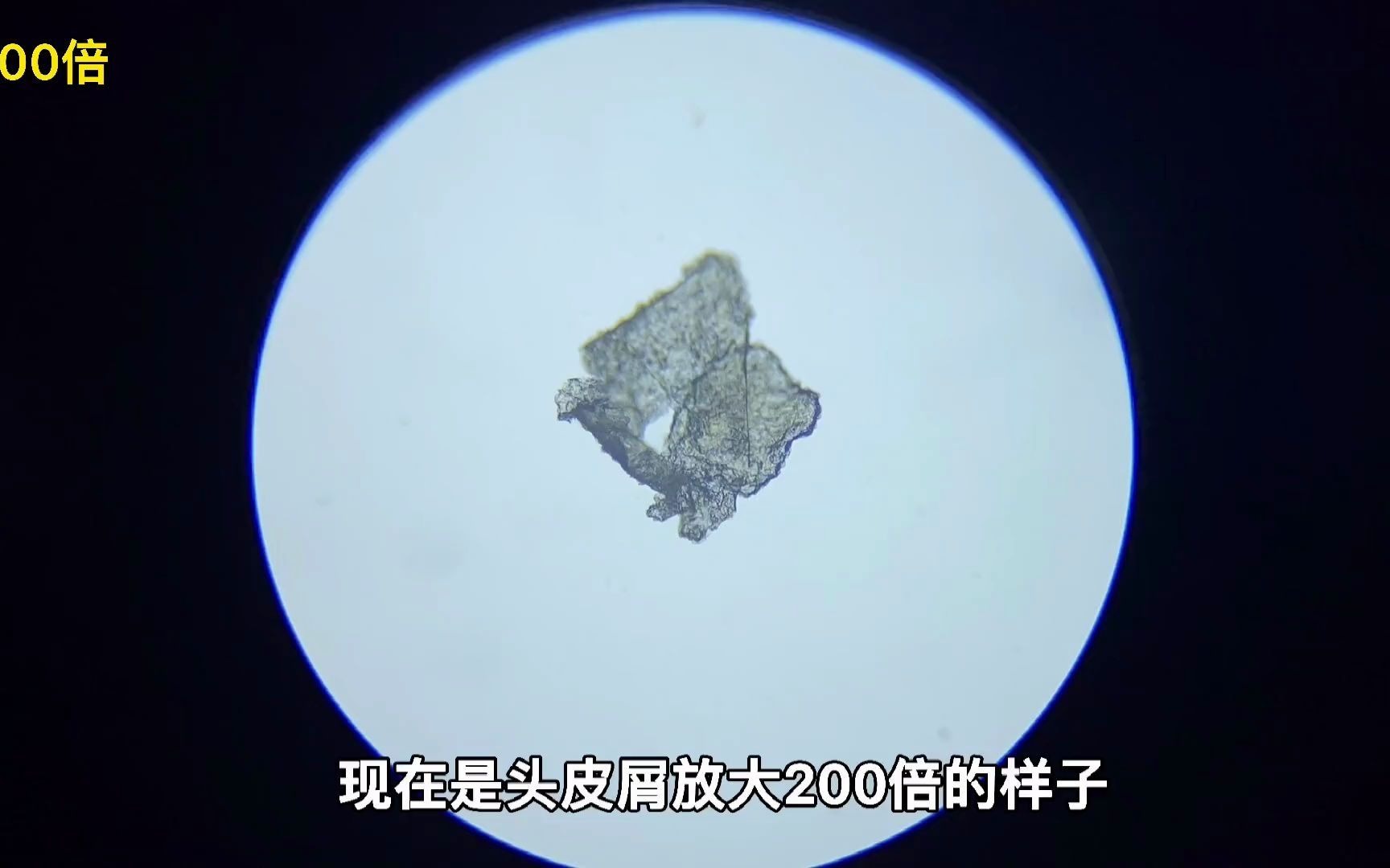 把人类头皮屑放大500倍 上面能看见很多纹理