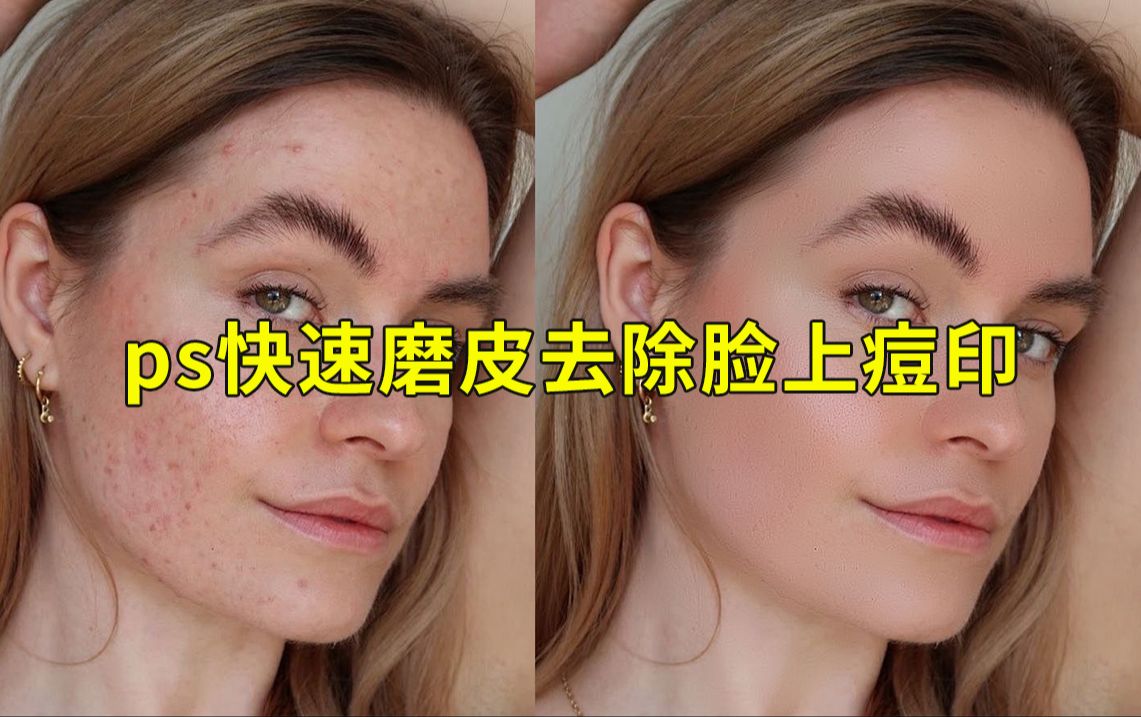 ps快速磨皮去除脸上痘印教程-小波电商设计-小波电商设计-哔哩哔哩视频