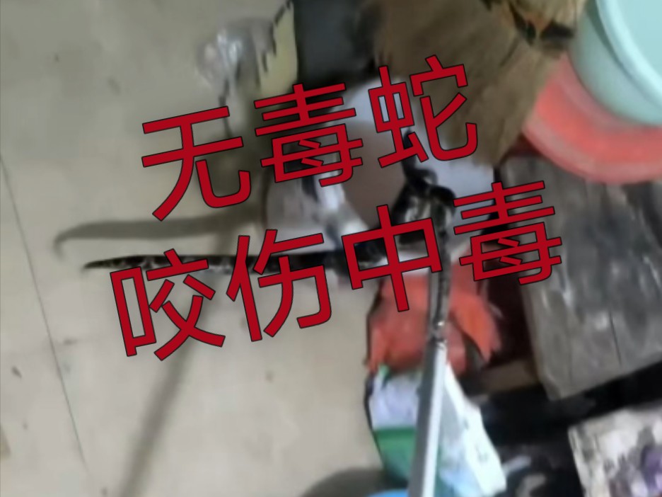 一女子被无毒蛇咬伤出现中毒症状,究竟是人性的扭曲还是道德的沦丧…②海岛竹叶青哔哩哔哩bilibili