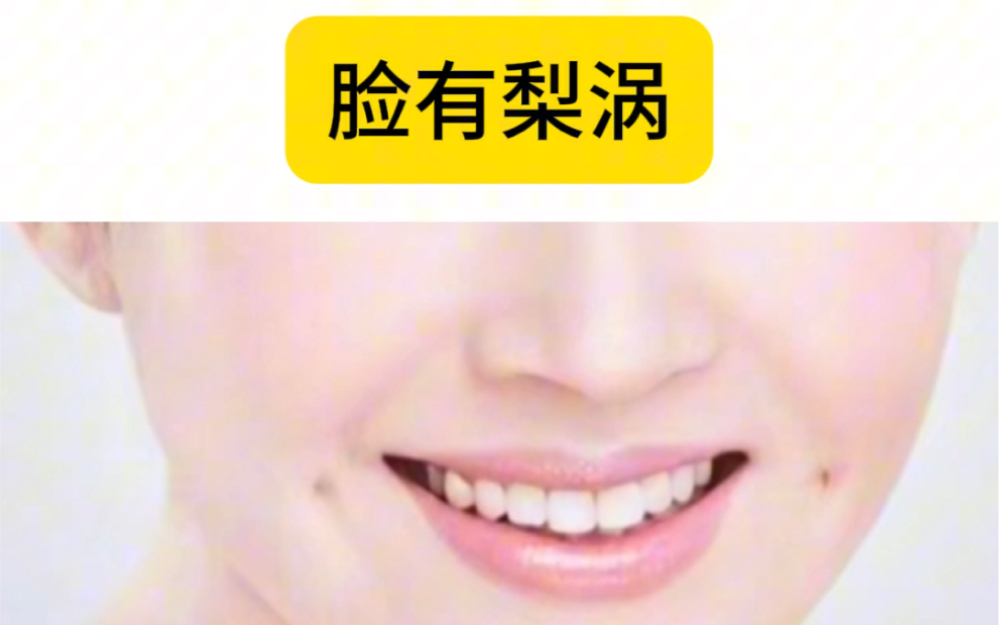 为什么会有酒窝 为什么会有酒窝