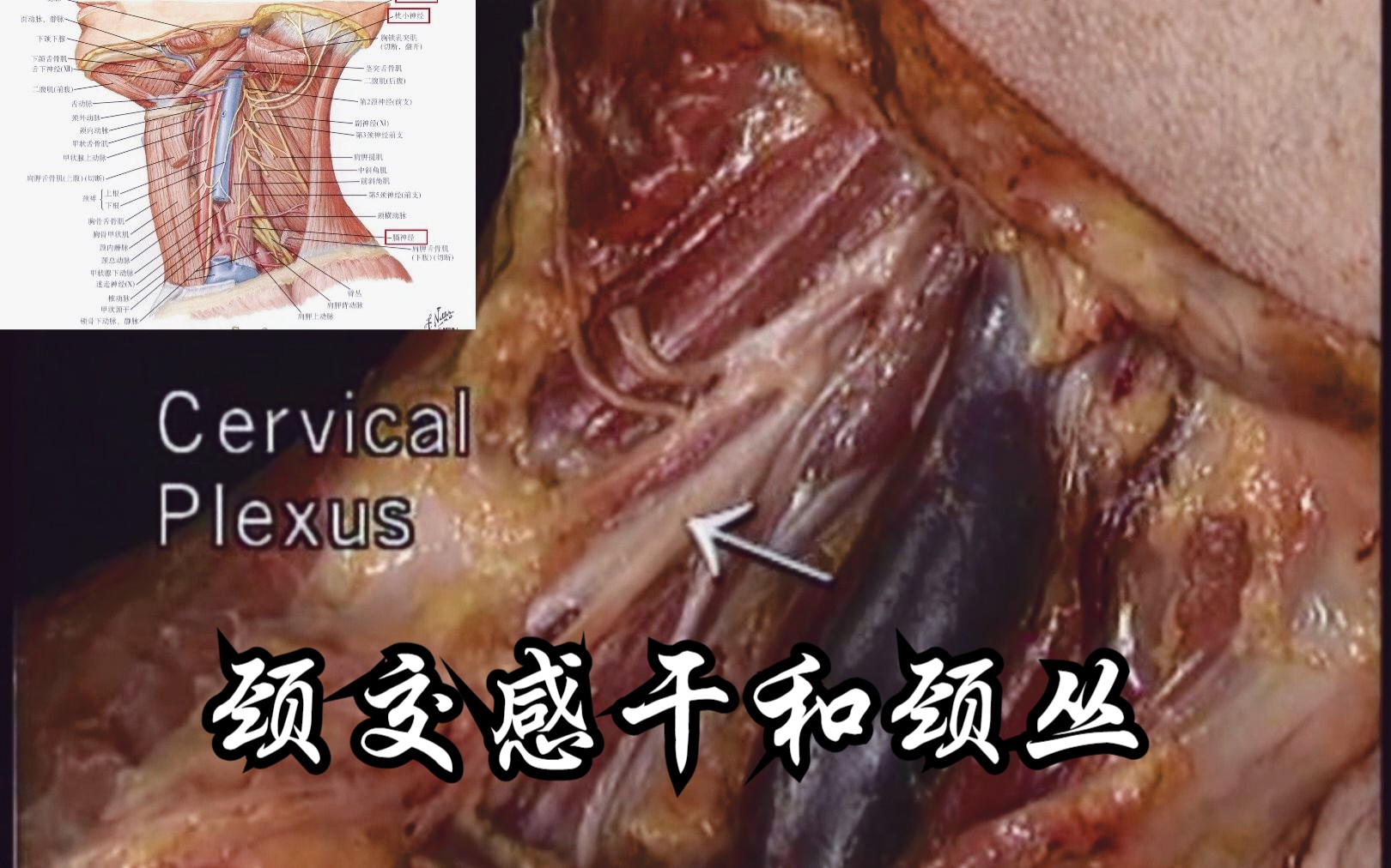 [图]颈交感干、颈丛