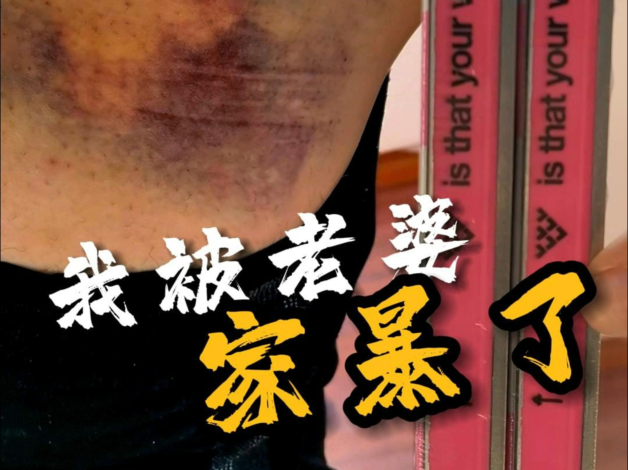 我被老婆家暴了!