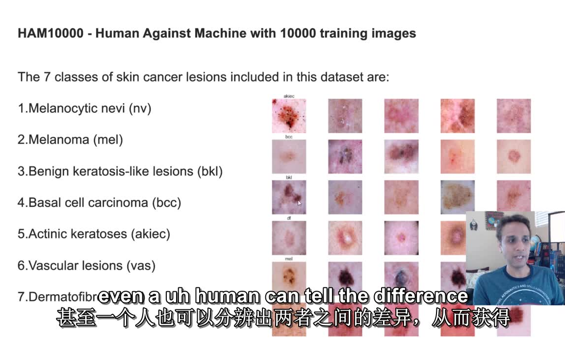 使用HAM10000数据集进行皮肤癌分类哔哩哔哩bilibili