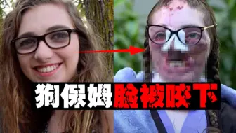 【兼职喂疯狗】女大学生被咬800次，全身赤裸脸都掉下来了