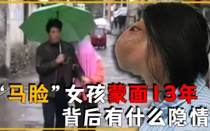 Download Video: 22岁女孩长着一张“马脸”，怕吓到人蒙面13年，背后隐情令人心痛