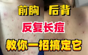 Download Video: 前胸后背，反复长痘怎么办？皮肤科医生教你正确处理！