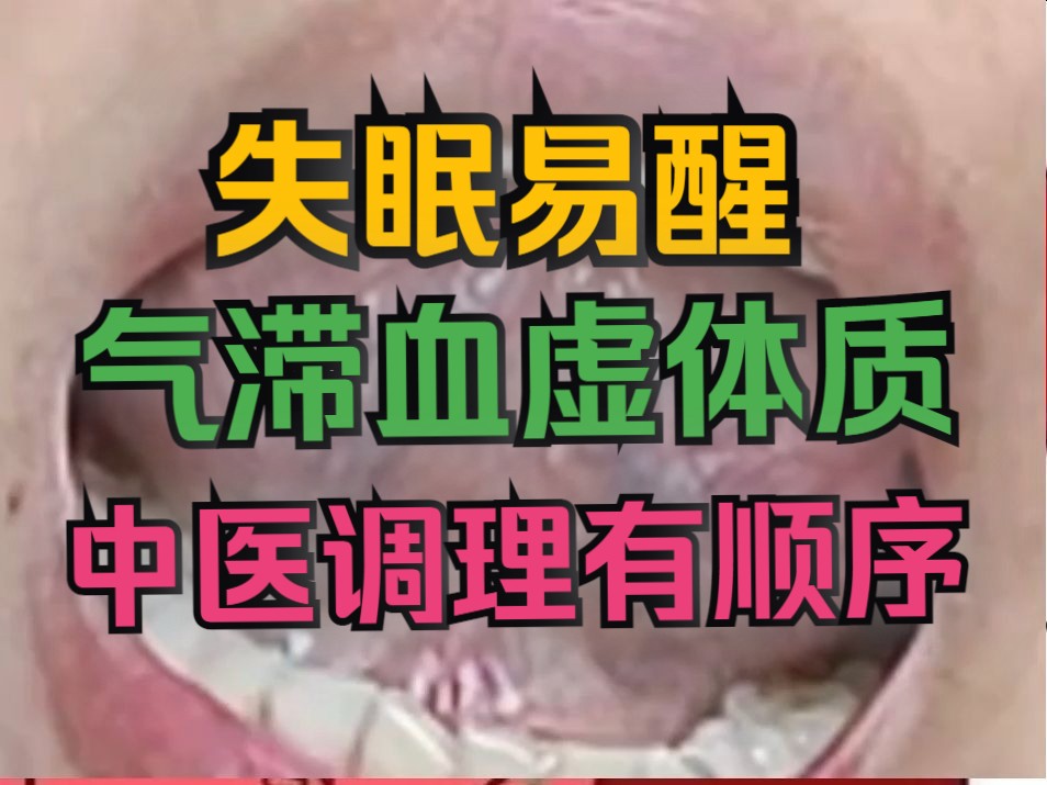 [图]舌诊分析：如何调理，夜半容易醒，有结节，气滞血虚中医给你讲明白