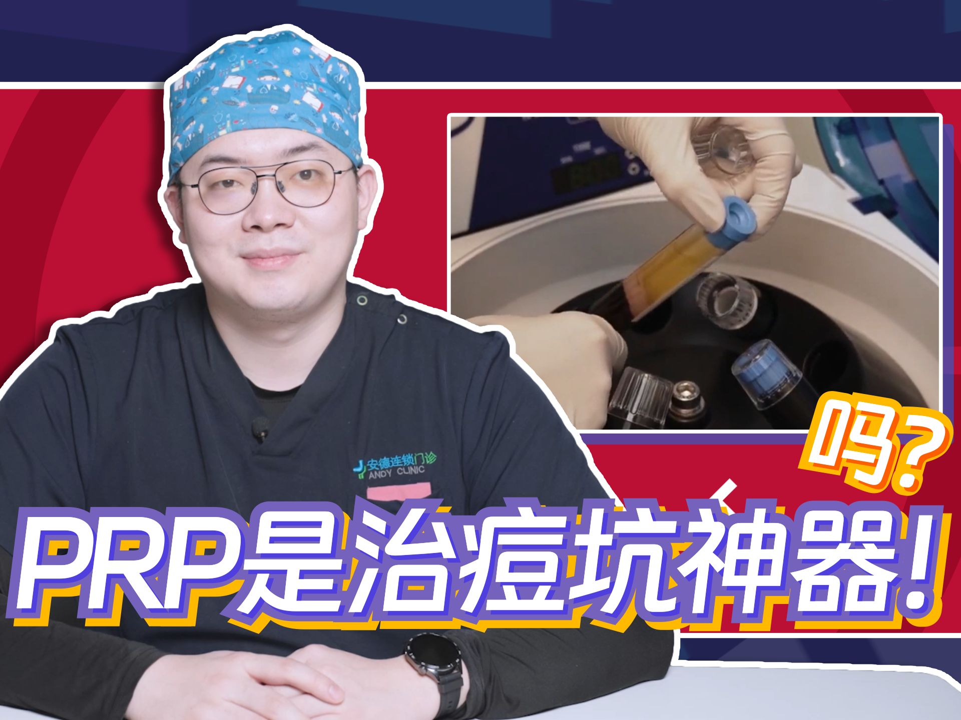 痘坑治疗新方法?PRP是什么?是否安全?效果又如何?哔哩哔哩bilibili