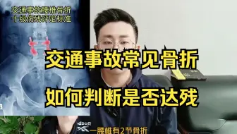 交通事故常见骨折如何判断是否达残