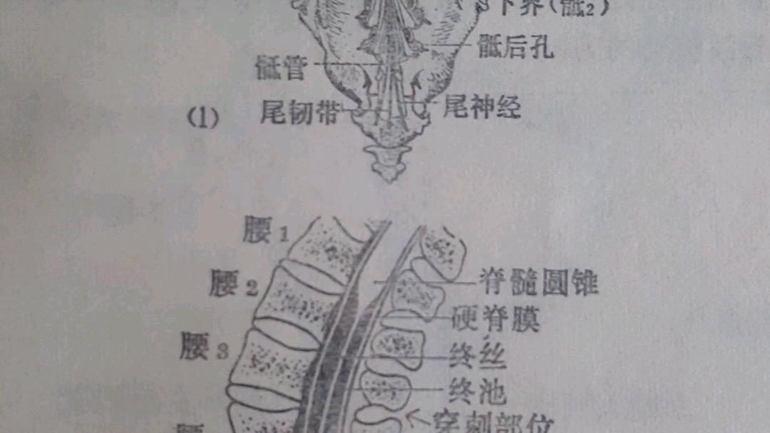 蛛网膜下腔终池的位置和内容哔哩哔哩bilibili