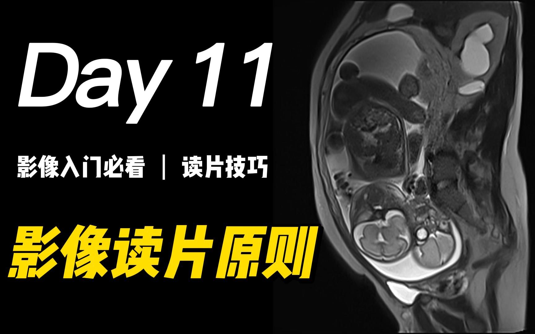 [图]影像读片解读：原则和技巧 | 医学生、医学影像学、医学影像技术、临床医学、影像医学与核医学、放射科、DR、CT、MR、诊断学