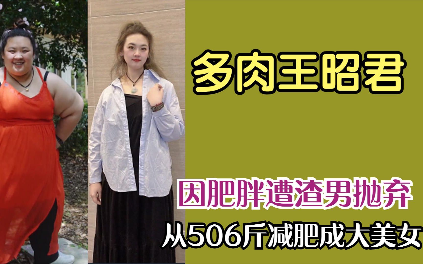 [图]多肉王昭君：因肥胖遭“渣男”抛弃，从506斤减肥逆袭成大美女！