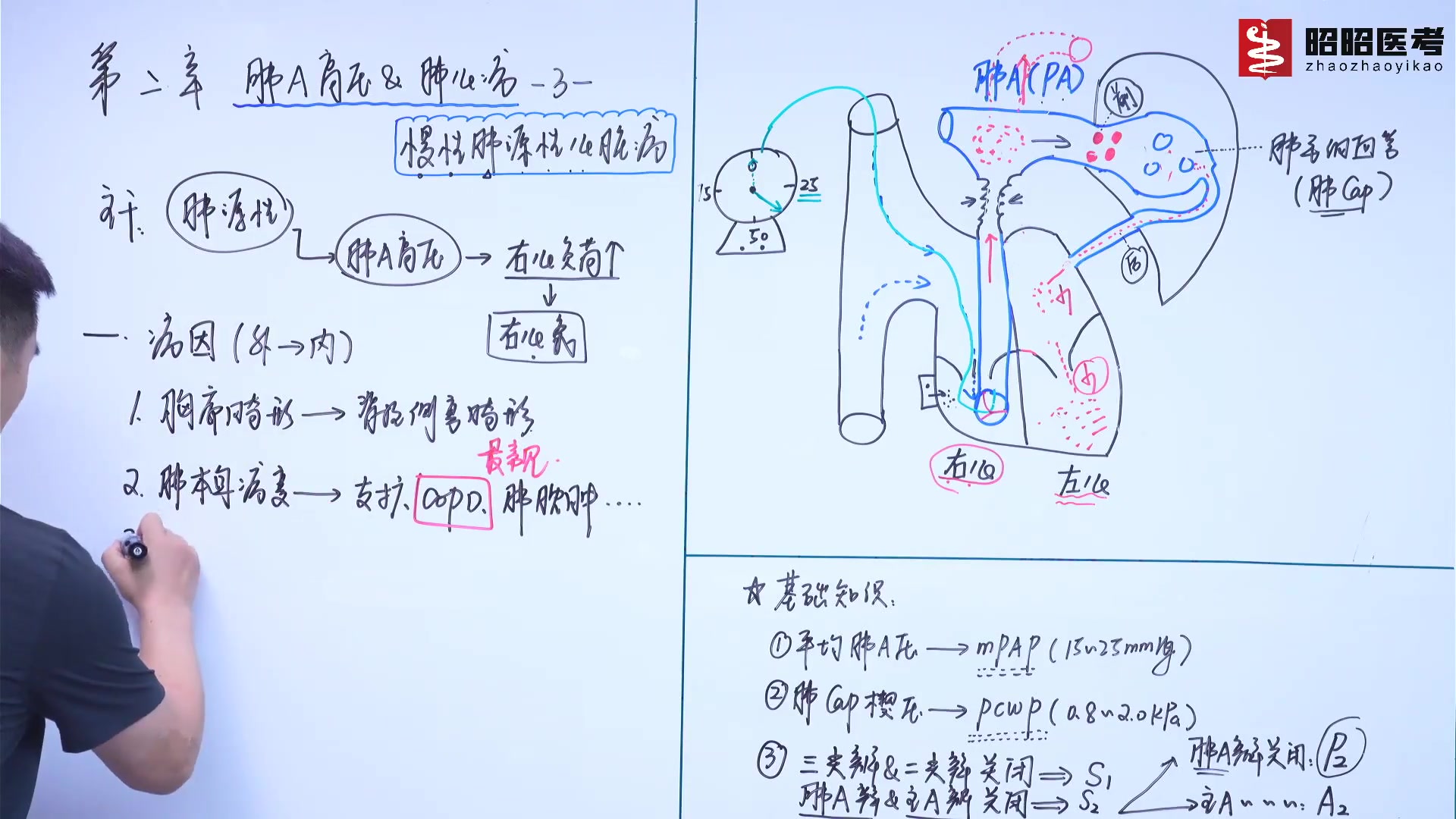 [图]昭昭医考-2023临床执业/助理医师考试视频-慢性肺心病