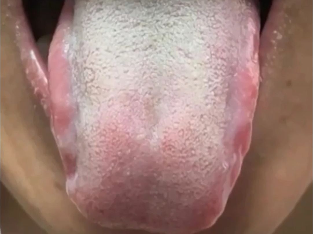 舌头两侧图片