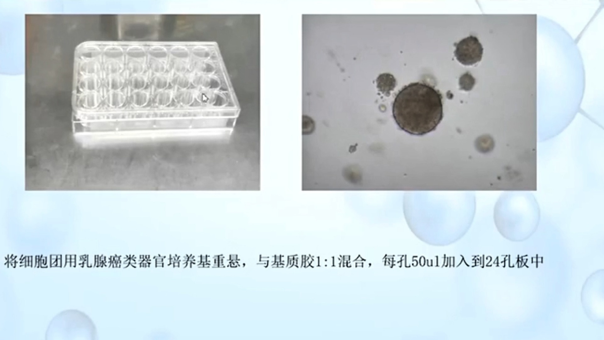 Tumor Organoid Culture Workflow Protocol