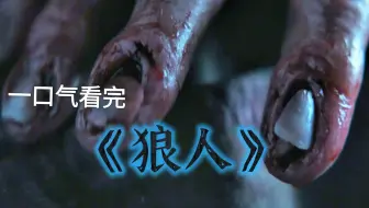 男子意外感染恐怖病毒