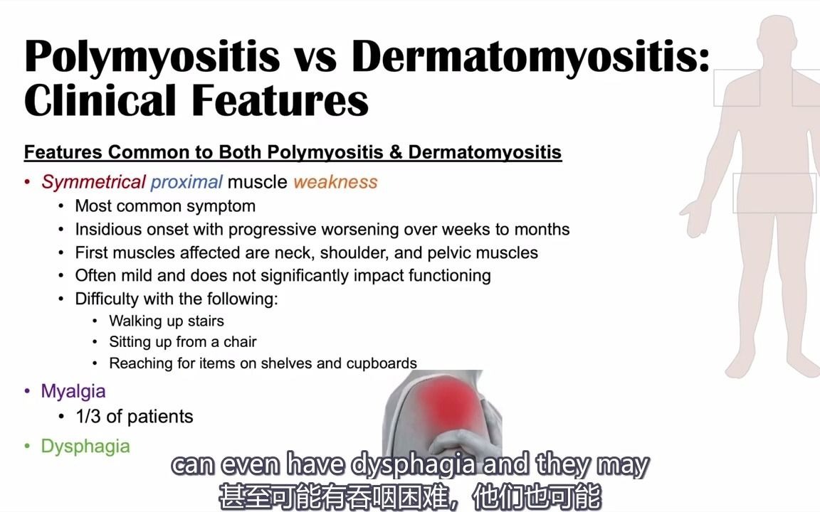 【医学科普】特发性炎性肌病(多肌炎VS皮肌炎) 肌肉破坏 风湿免疫科 双语实用内科学课程系列哔哩哔哩bilibili