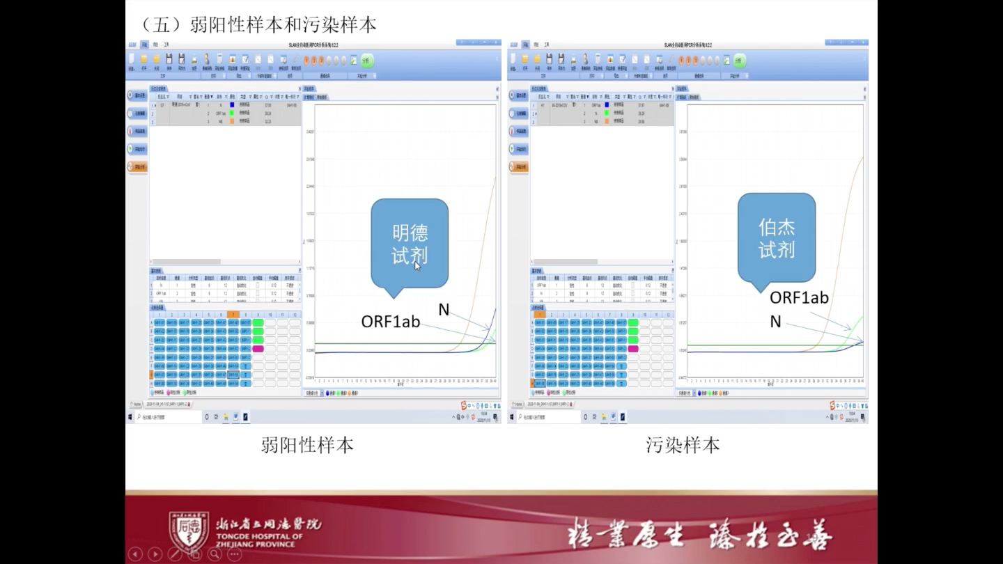 [图]03-张永乐_新冠核酸检测结果解读案例分享