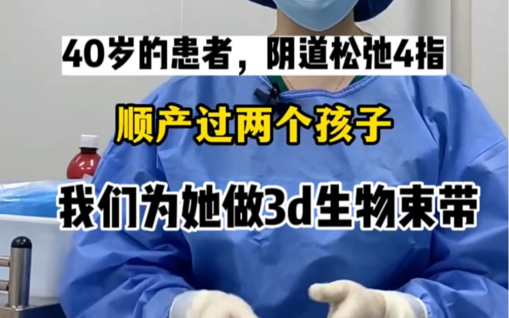 40岁的二胎妈妈,阴道松弛4指,我们相信生物束带会为她带来最好的体验哔哩哔哩bilibili