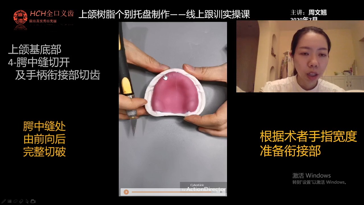 5周文翘:第2次课:《上颌个别托盘制作》