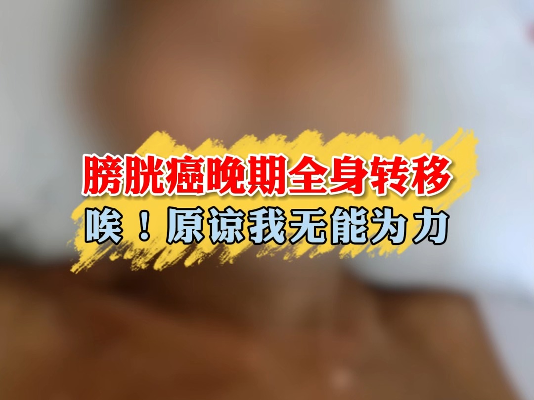 膀胱癌晚期全身转移 唉!原谅我无能为力哔哩哔哩bilibili