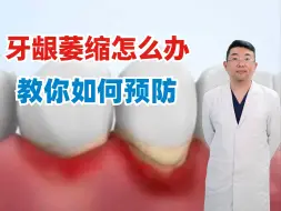 Tải video: 牙龈萎缩怎么办，教你如何预防！