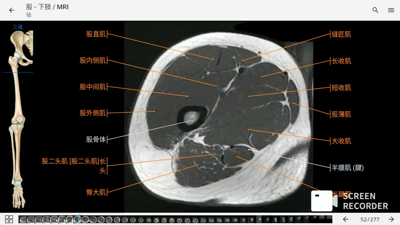 [图]影像解剖图谱神器 医学影像学必备 e-anatomy中文最新版 下肢MRI