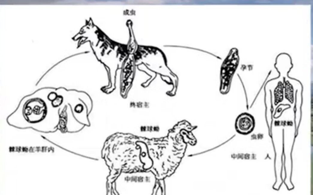 女孩患上虫癌包虫病,肝脏长满寄生虫,医生耗时十四小时手动剥除2斤寄生虫哔哩哔哩bilibili