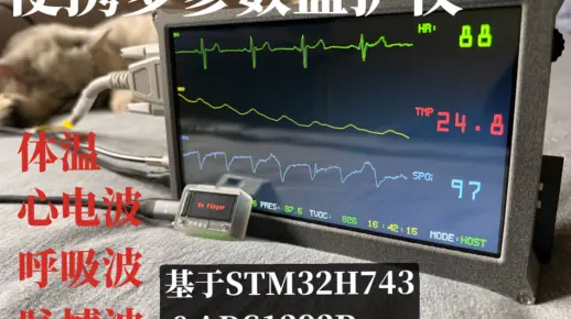 毕设开源项目：便携多参数监护仪