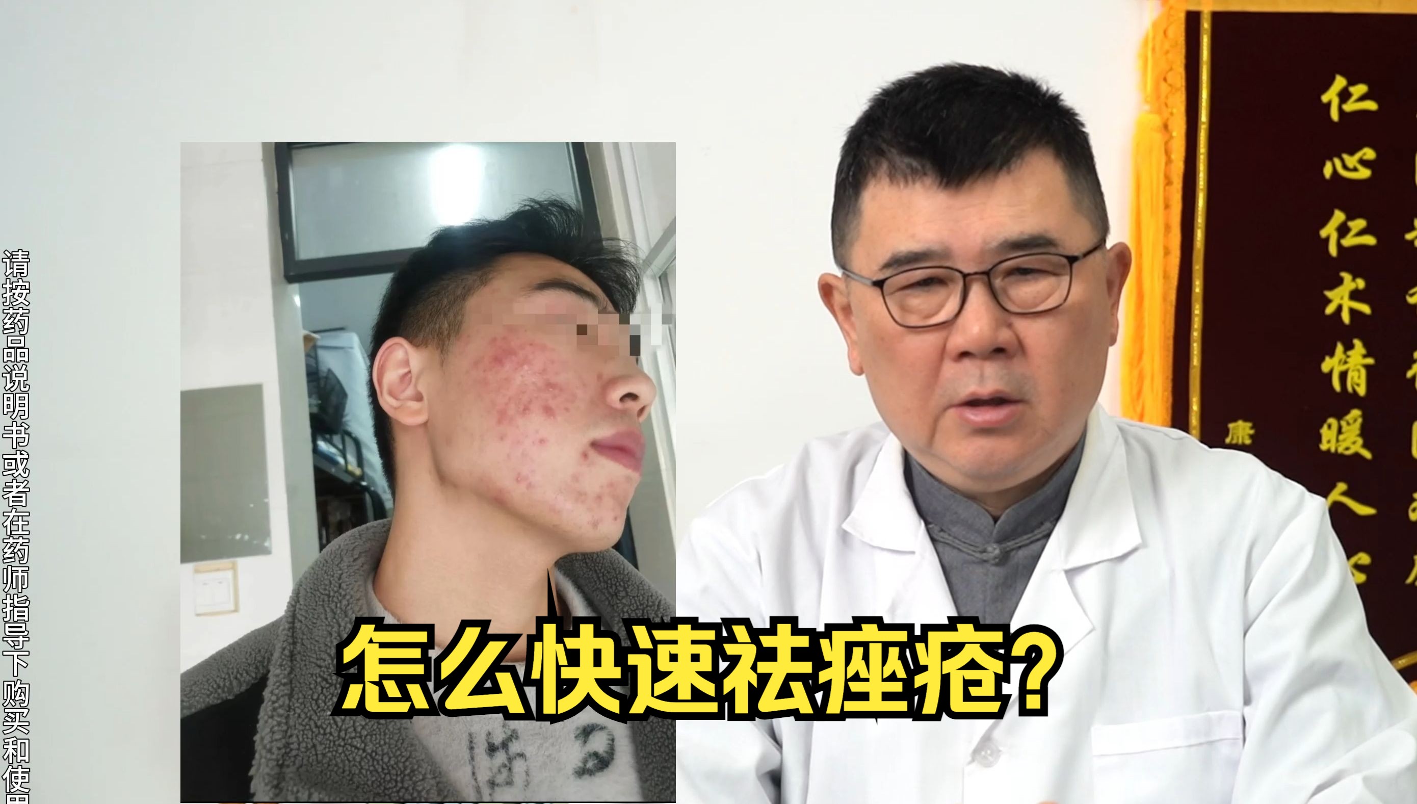 青春痘一定要早治疗!小心越长越多!