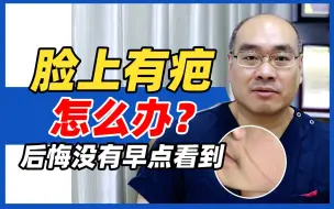 Download Video: 脸上有疤痕怎么办？后悔没有早点看到！