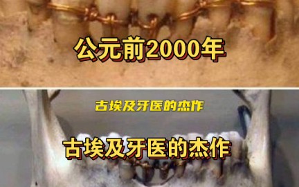 公元前2000年古埃及牙医的杰作哔哩哔哩bilibili