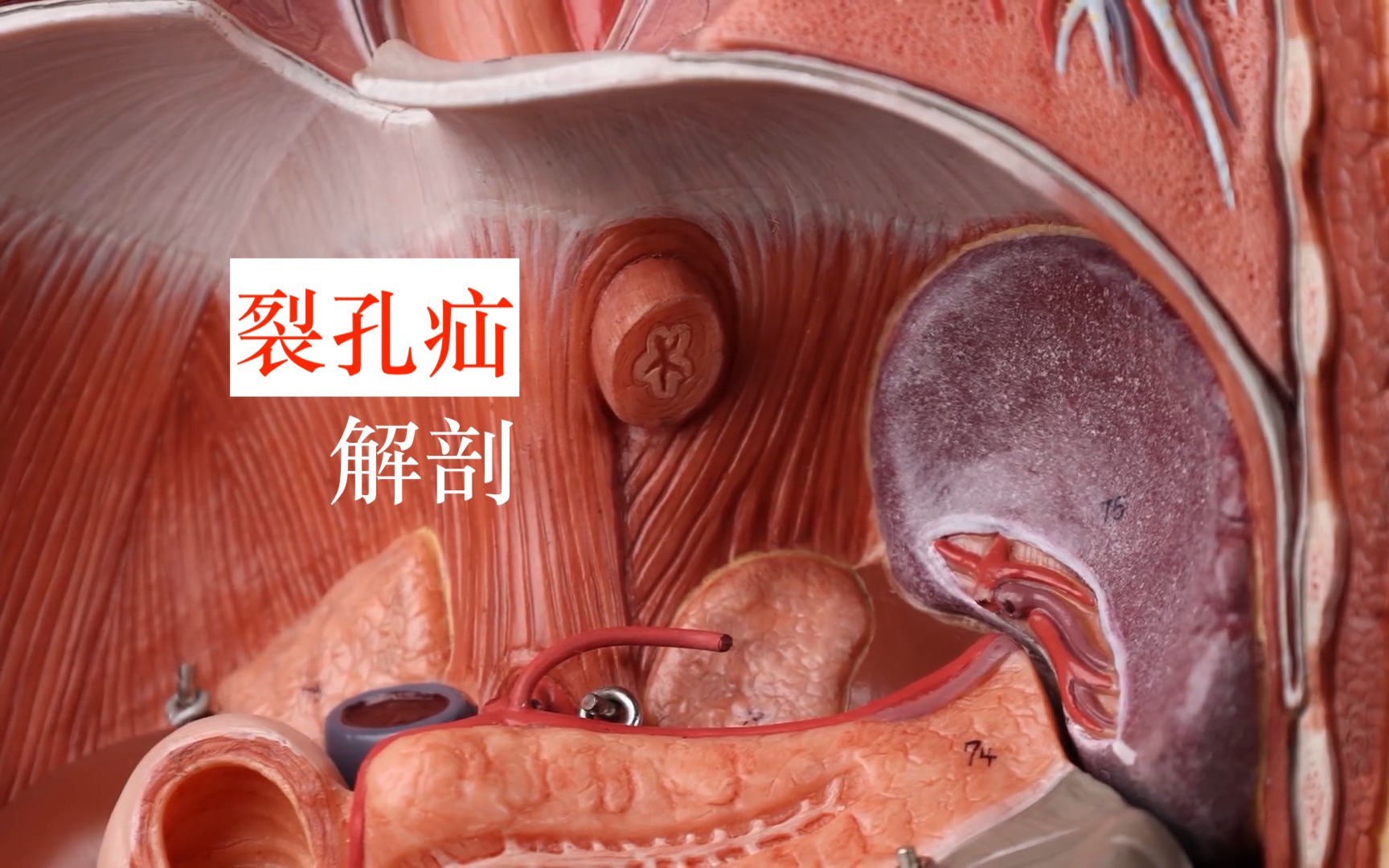 [图]食管裂孔疝【解剖】