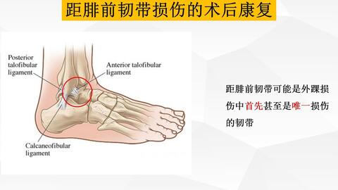 前交叉韧带acl重建术后康复 第4阶段 哔哩哔哩 Bilibili