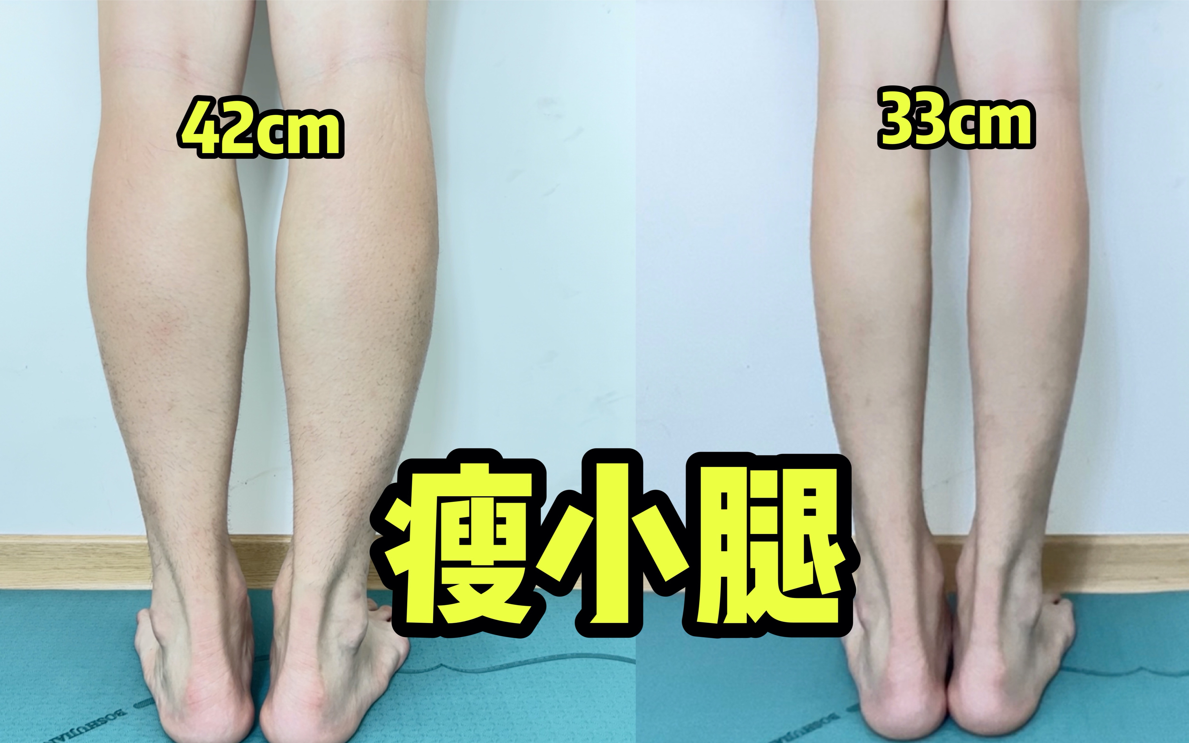 腿围减了9cm 脂包肌小腿解决方案 摆脱粗壮!哔哩哔哩bilibili