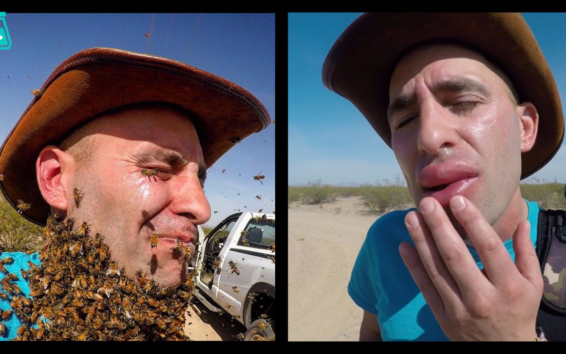 外国人为什么少 3000只蜜蜂爬在脖子和脸颊是什么体验_搞笑_生活_哔哩