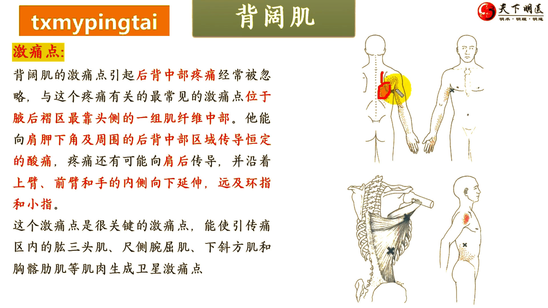 阔背肌疼痛图片