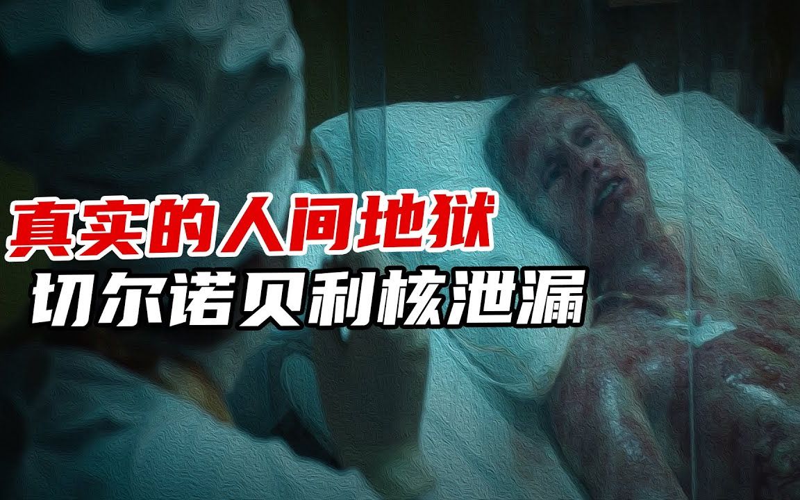 切爾諾貝利核洩漏事件,一個真實的人間地獄,直接死亡9.3萬人