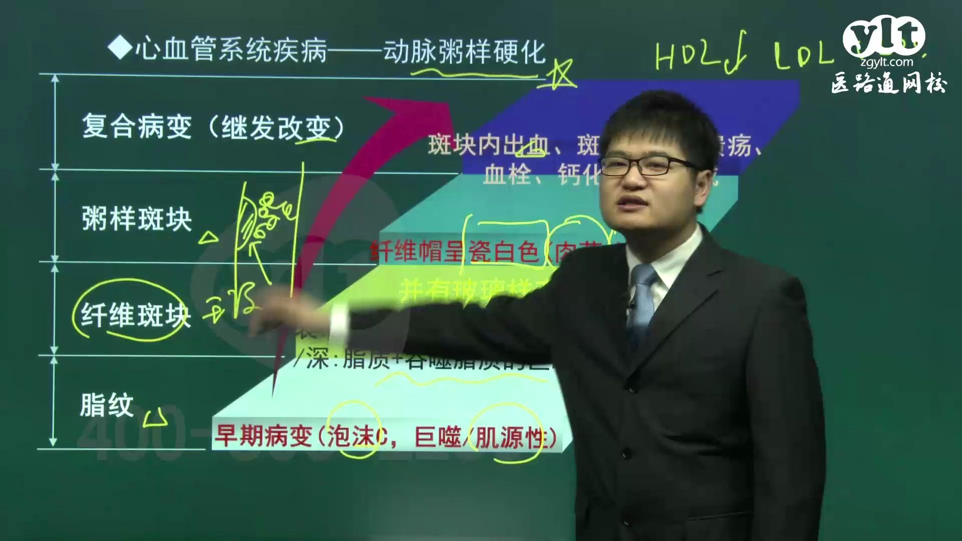 临床执业医师考试 病理学心血管系统疾病哔哩哔哩bilibili